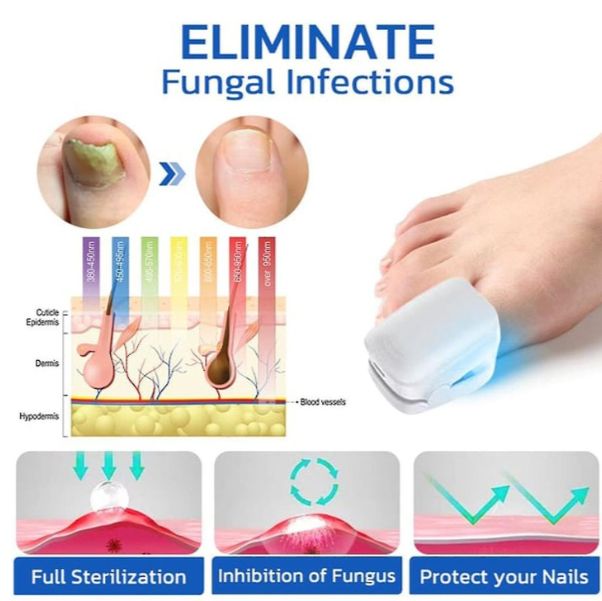 Fungal Nail Treatment (WHITE)