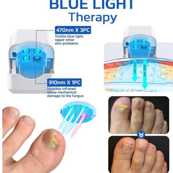Fungal Nail Treatment (WHITE)